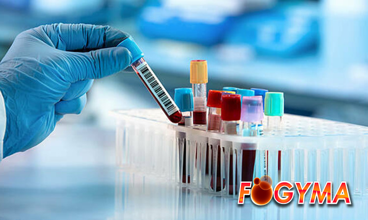 Hematocrit (Hct) 1