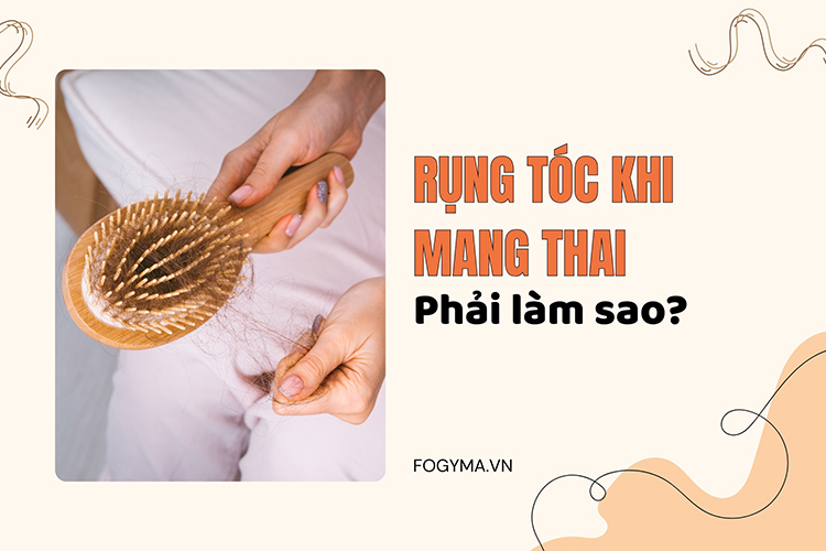 Rụng tóc khi mang thai phải làm sao? 1