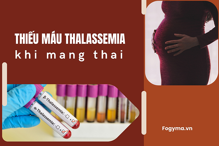 Thiếu máu thalassemia khi mang thai và những điều cần biết 1